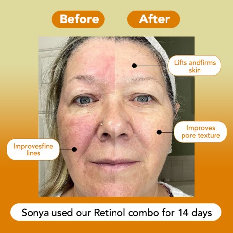 Advanced Triple Retinol Anti-aging Combo