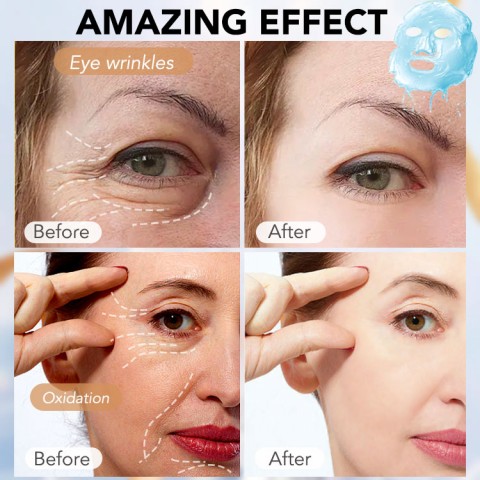 ELLEN ELLA Triple Retinol Niacinamide Anti Aging Whitening Facial Mask Set 5pcs