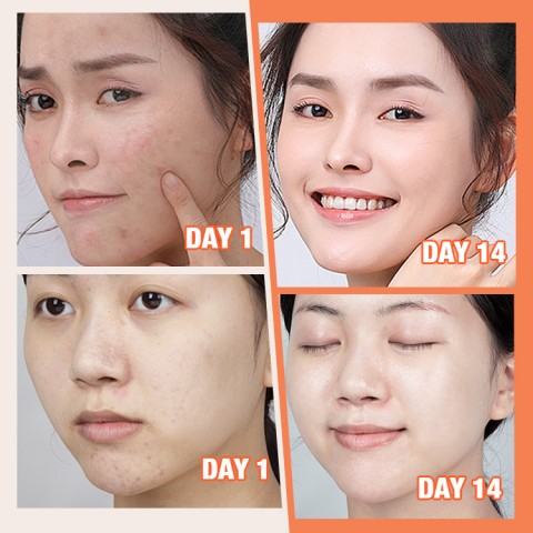 ELLEN ELLA  Upgraded Morning & Night Face Cream