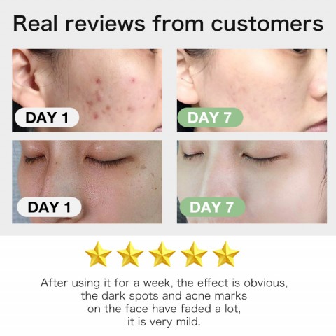 ELLEN ELLA Triple Retinol Anti Aging and Firming Face Serum