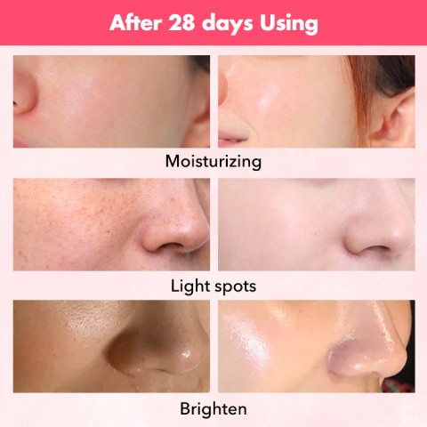 ELLEN ELLA Niacinamide Rose Skin Care Combo