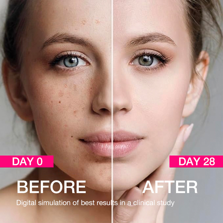 Second Only 400pesos-ELLEN ELLA Radiant Whitening Boost Serum