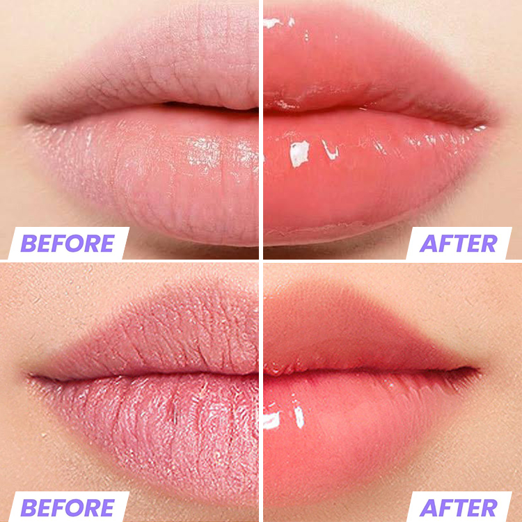 Lip Serum