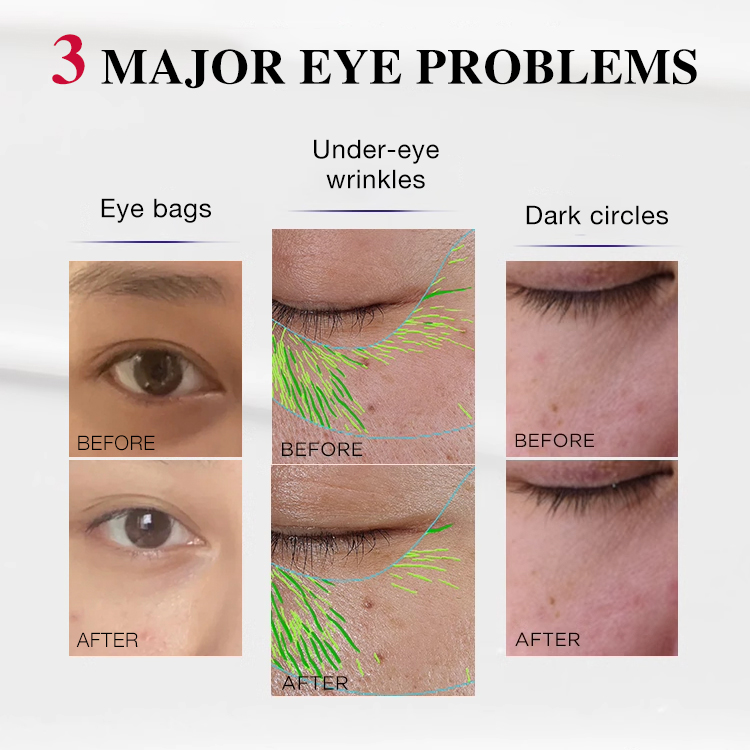 Mid-Year Mega Sale - BUY 1 GET 1 - ELLEN ELLA Anti-Aging Eye Cream | Dark Circles + Eye Bags + Wrinkles - Make you 20 years younger