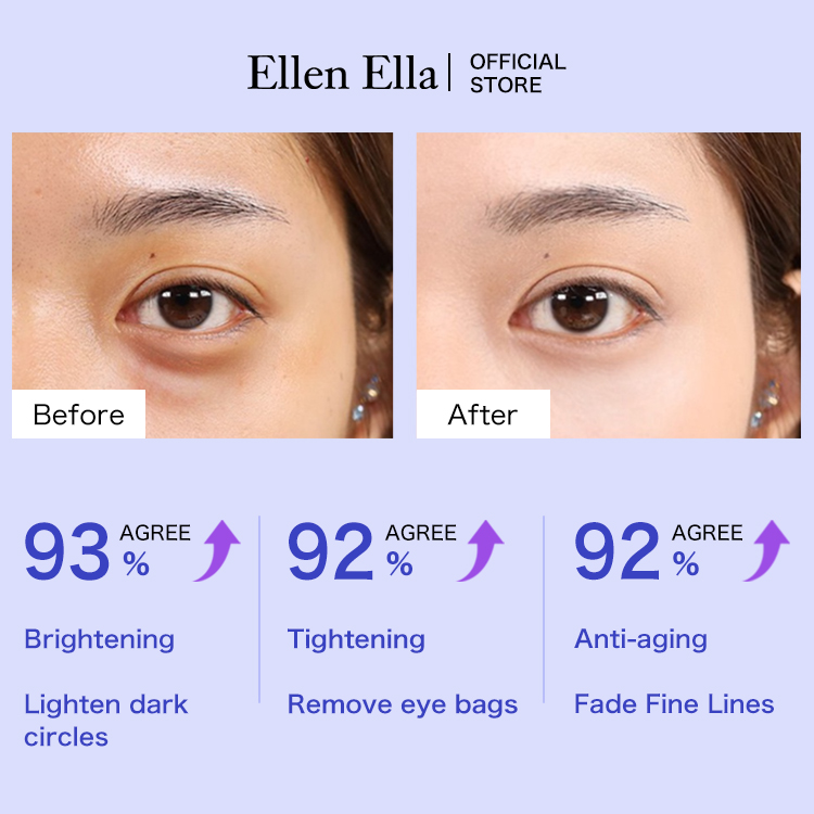 Buy 1 Take 1 only 950 - ELLEN ELLA Advanced Eye Cream - Remove Dark Circles, Eye Bags, Wrinkles