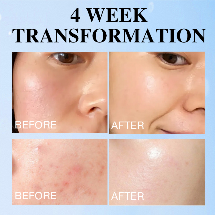 ELLEN ELLA Triple Retinol Niacinamide Anti Aging Whitening Facial Mask Set 5pcs