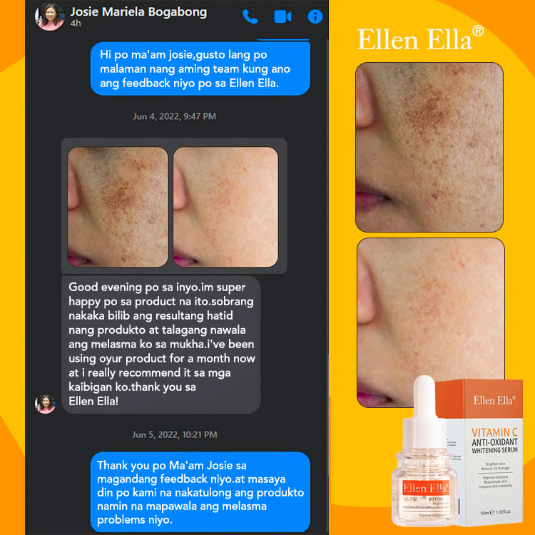Ellen Ella Whitening Glow Serum buy one take one - Get Brighter Skin in 4 Weeks - Fades freckles, melasma and sun spots 