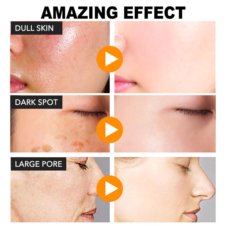 Ellen Ella Whitening Glow Serum buy one take one - Get Brighter Skin in 4 Weeks - Fades freckles, melasma and sun spots 