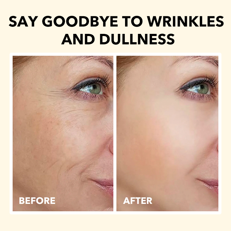 Best Gift Ellen Ella 4X Retinol Anti-aging Combo, Target wrinkles & spots, 10 years younger